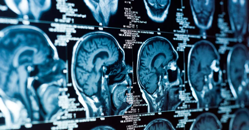 Раскрыт механизм формирования долговременной памяти