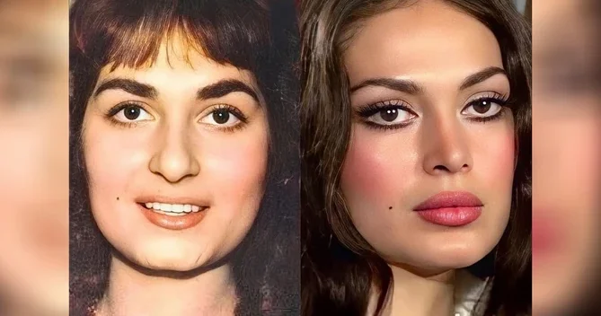 Türkan Şorayı dəyişdirən PLASTİK ƏMƏLİYYATLAR VƏ QİYMƏTLƏRİ FOTO