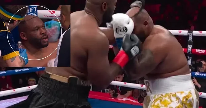 Nyu Yorkda boks gecəsində yarışçının pariki ringdə düşdü