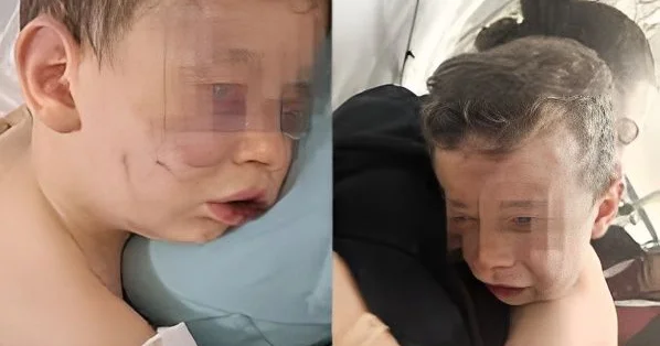 2 yaşlı uşaq vəhşicəsinə döyüldü FOTO