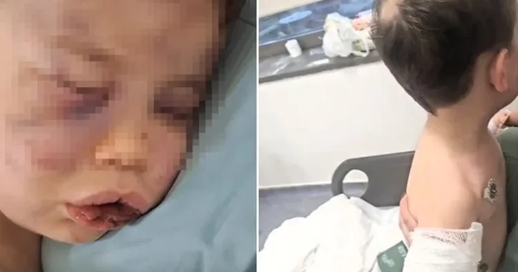 Anasının sevgilisi 2 yaşlı körpəyə dəhşət yaşatdı: vəziyyəti kritikdir
