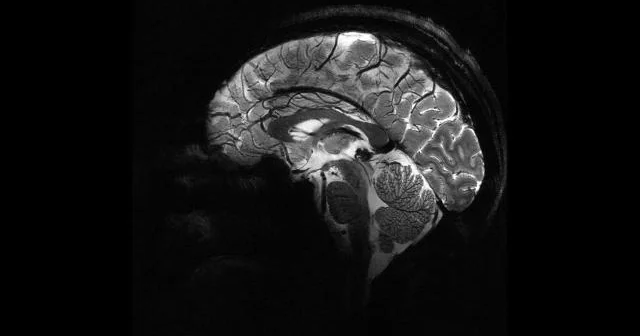 Alimlər beyinlə əlaqə qura bilən süni sinir hüceyrələri hazırlayıblar