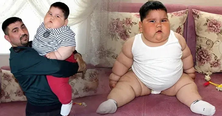 5 yaşında 90 kilo idi, 11 yaşında 40 kiloya düşdü Hər kəsi təəccübləndirdi
