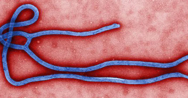 Xüsusi Təhlükəli İnfeksiyalara Nəzarət Mərkəzi: Azərbaycanda Ebola xəstəliyinin yayılması riski aşağı qiymətləndirilir