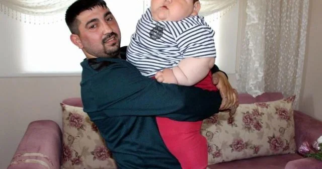 5 yaşında 90 kilo idi İndi onu görənlər inana bilmirlər FOTO