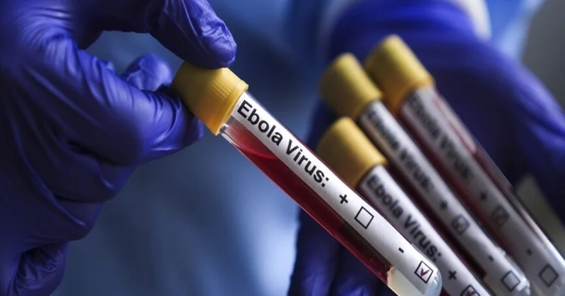 SN: Ebolanın Azərbaycanda yayılma riski aşağıdır, əhali üçün xüsusi tədbirlərə ehtiyac yoxdur