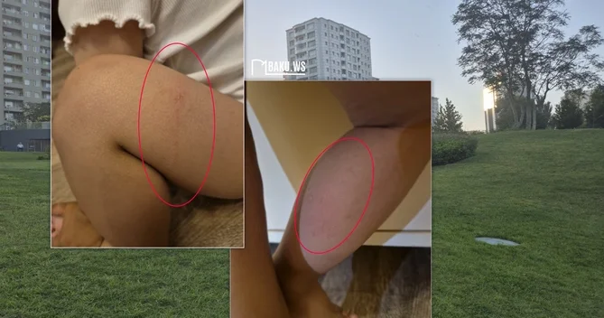 Mərkəzi Park da 2 yaşlı uşaq kanalizasiya quyusuna düşdü