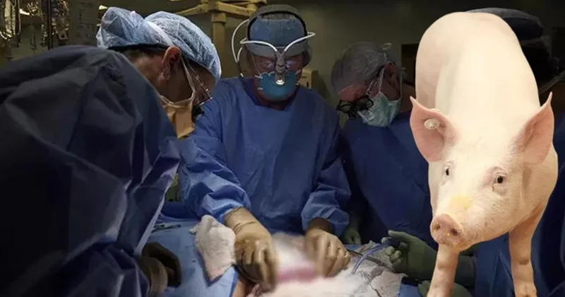 Dünyada ilk dəfə donuzdan insana ağciyər transplantasiyası həyata keçirilib