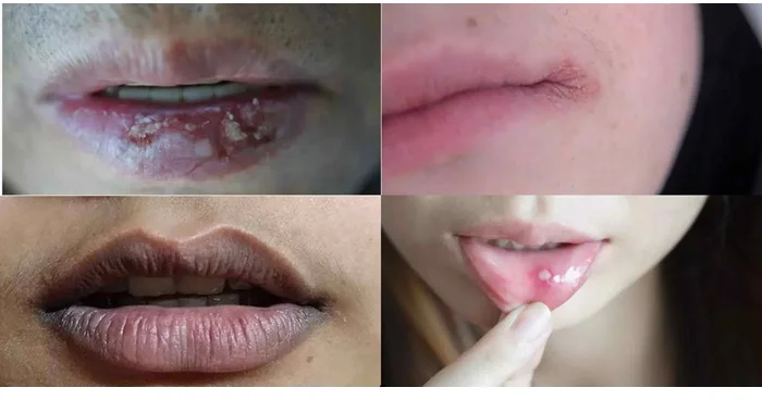 Uçuq kimi görünsə də, ciddi xəstəliklərin əlaməti ola bilər