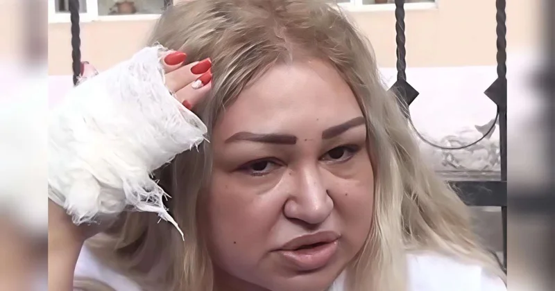 "Telefonu başımda qırmaq istədi..." Döyülən müəllim danışdı VİDEO