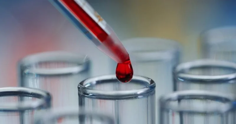 Alimlər xroniki yorğunluq sindromu üçün qan testi hazırlayıblar