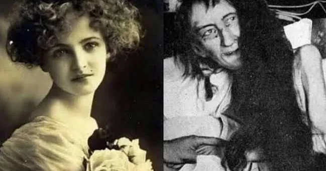 Anasının 25 il otaqda zəncirlədiyi qadının dəhşətli heyakəsi