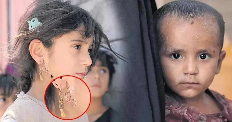 İqlim dəyişikliyi: Hər il beş yaşadək 600 min uşaq ölür