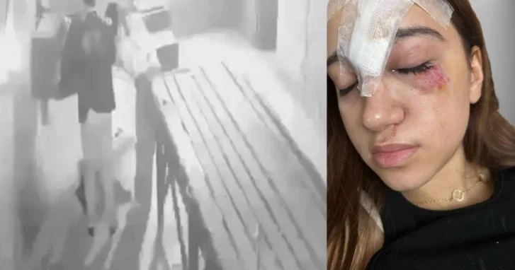 Игра вышла из под контроля: подросток серьезно пострадала в развлекательном центре Баку