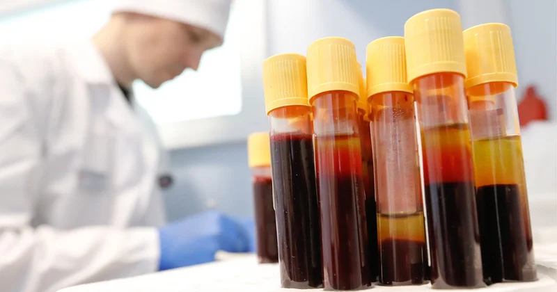 The Moscow Times: Россия сравнялась с Африкой по распространению ВИЧ