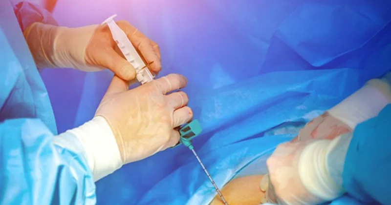 Bu 5 xəstəxanaya sümük iliyi köçürülməsinə icazə verildi