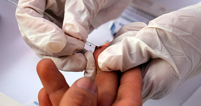 В Азербайджане выявлено более 11 тысяч граждан с ВИЧ