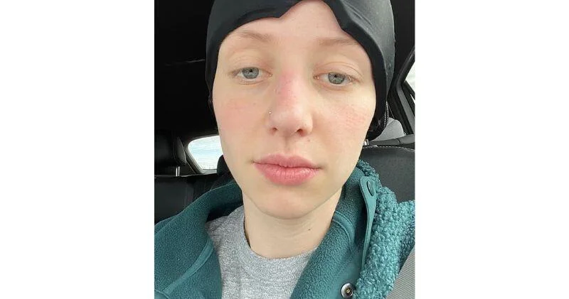 У 32 летней женщины с покалыванием в руке нашли рак мозга