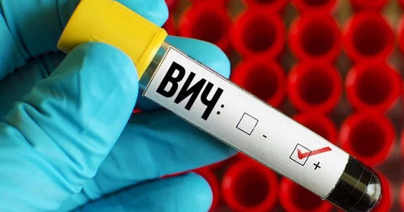 Стало известно, сколько людей, инфицированных ВИЧ в Азербайджане, заразилось за рубежом