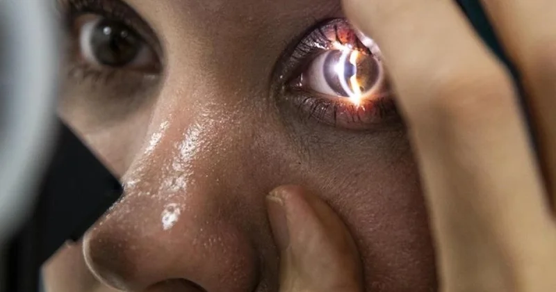 Süni intellektə həddən artıq etibar göz müalicəsini çətinləşdirir