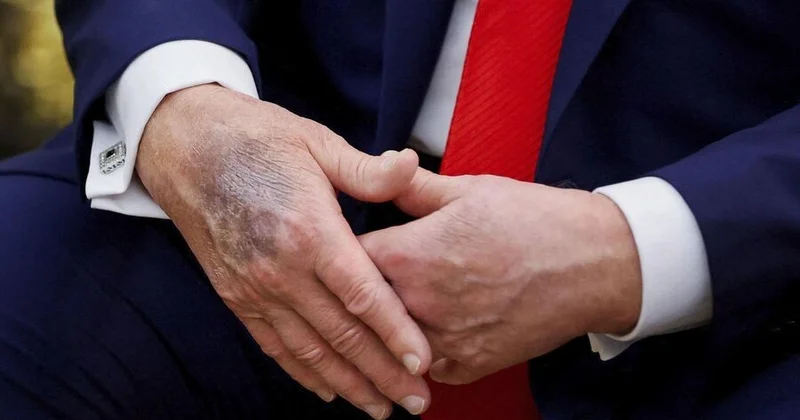 Стало известно о попытках Трампа скрыть старение