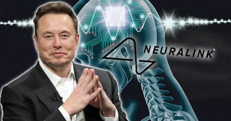 İlon Mask elan etdi: Beyin implantlarının kütləvi istehsalı başlayacaq