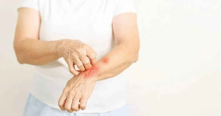 Türkiyənin allergiya xəritəsi hazırlandı