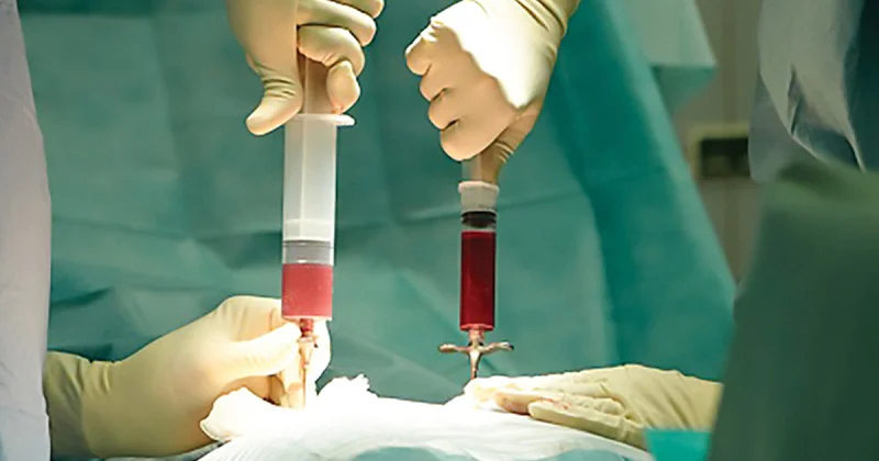 Бесплатная трансплантация костного мозга в Азербайджане