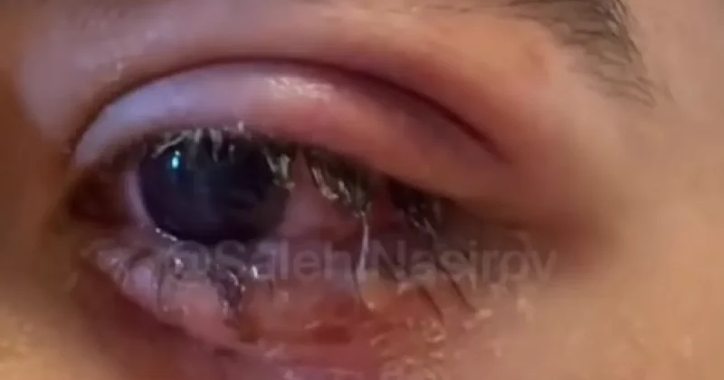 Пиротехника запрещена, но она калечит азербайджанских детей Как контрабандисты обходят закон? / ВИДЕОФАКТ