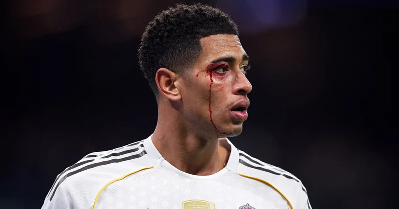 Real Madrid in ulduzu uzun müddətə sıradan çıxdı