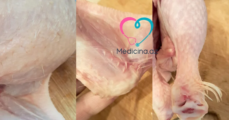 Tükü yaxşı yonulmamış broyler toyuqları təhlükəlidir? Açıqlama