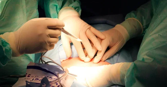 Görünməmiş olay: Bağırsağında 1 ci Dünya müharibəsindən qalan mərmi tapıldı