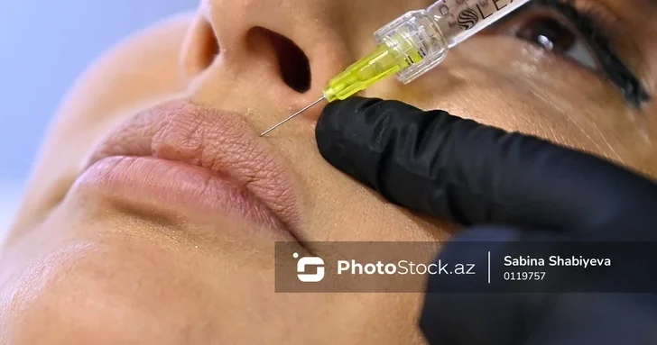 Бакинский косметологический центр оштрафован на 5000 манатов