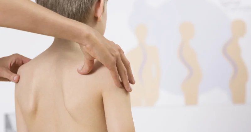 Детский сколиоз: как это лечится?