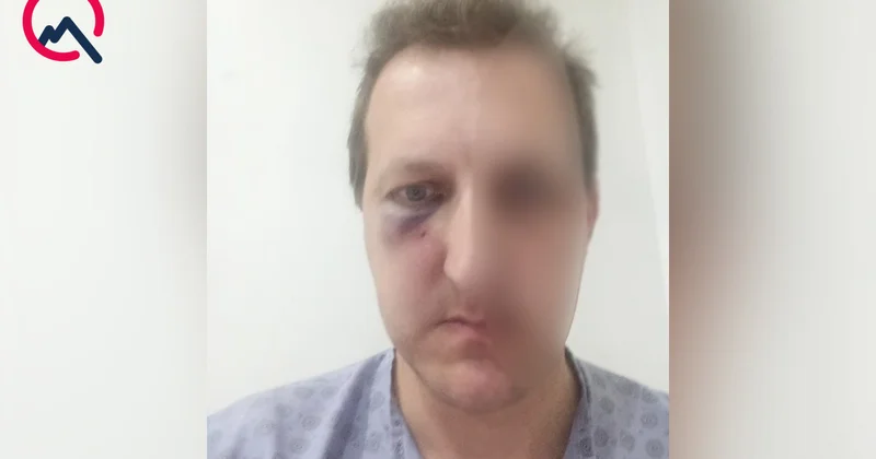 Xalq artistinin oğlunun döyülməsinə görə daha 2 şəxs saxlanıldı