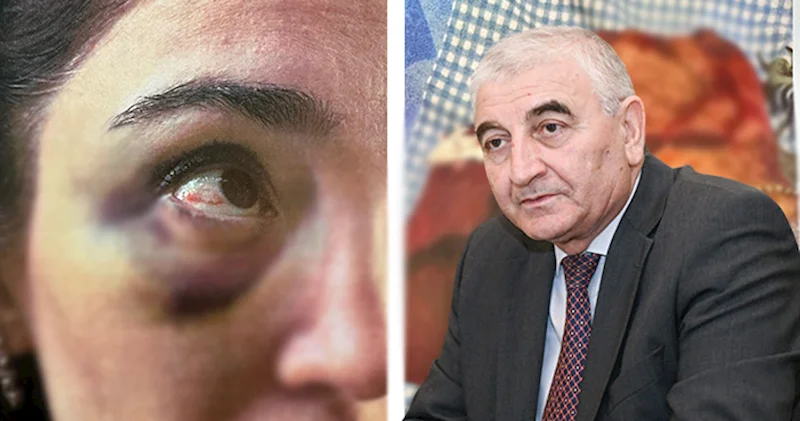 Məzahir Pənahovun oğlunun həyat yoldaşına qarşı zorakılıq etdiyi iddia olunur Fotolar