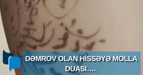 Cahilliyin buynuzu olmur ha...