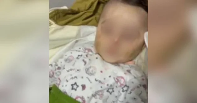 Valideynləri körpəyə fiziki zorakılıq göstərib Araşdırma başladı
