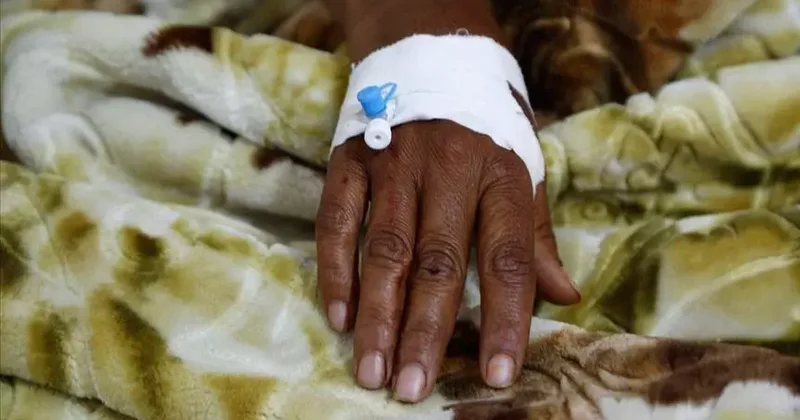 Nigeriyada vəba epidemiyasında 34 nəfər ölüb
