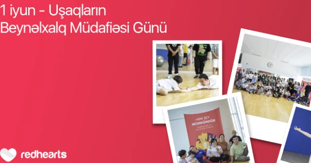 Hər şey mümkündür: Daun sindromlu uşaqlar üçün sosial layihə