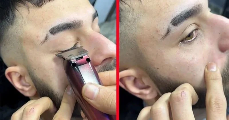 TikTok da “Kiprik kəsmə trendi”: Türkiyəli həkim xəbərdarlıq edir
