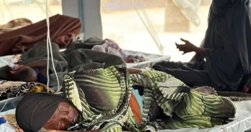 ÜST: Sudanda vəba epidemiyasının son dalğasında 120 nəfər ölüb