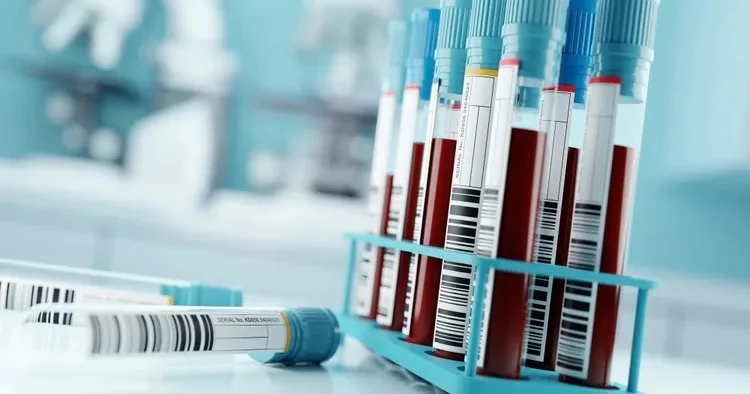 Milyonlarla insana ÜMİD İŞIĞI Süni intellekt xərçəngi tapacaq