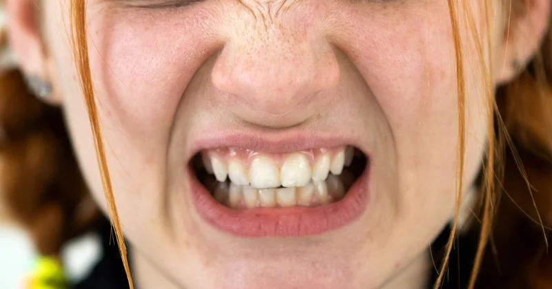 Dişlərinizi sıxmayın: Miqrenə səbəb olur