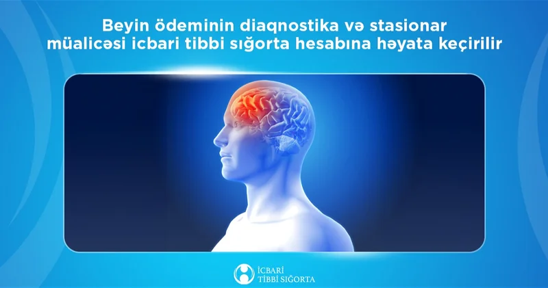Диагностика и стационарное лечение отёка мозга осуществляется за счёт ОМС