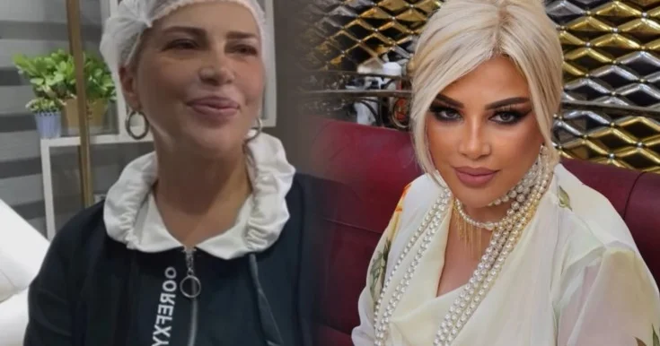 Mətanət İsgəndərlinin plastik əməliyyatdan sonrakı halı Foto