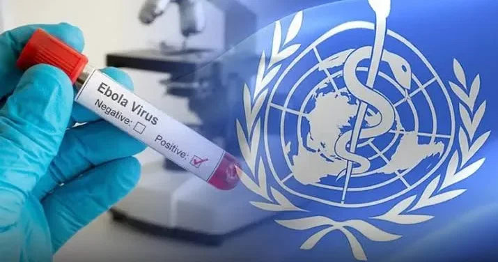 Ebola sürətlə yayılır ÜST dən HƏYƏCAN TƏBİLİ