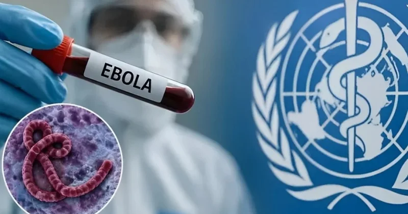 Ebola tarixdə görünməmiş sürətlə yayılır KONKRET