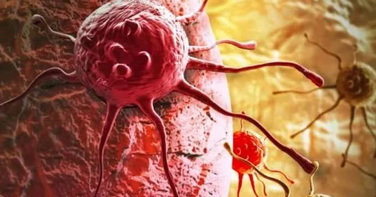 Tanınmış həkim xərçəngin səbəblərin açıqladı