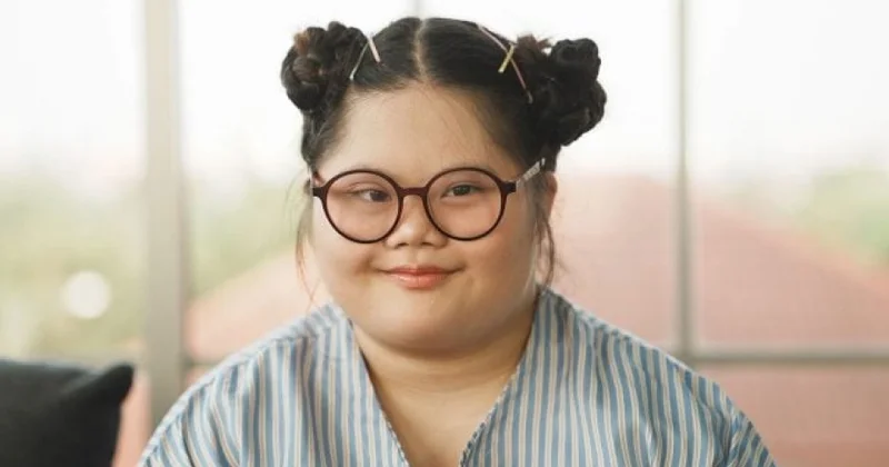 Tədqiqat: Daun sindromunda beyin funksiyasını yaxşılaşdırmağın yeni yolu kəşf edilib